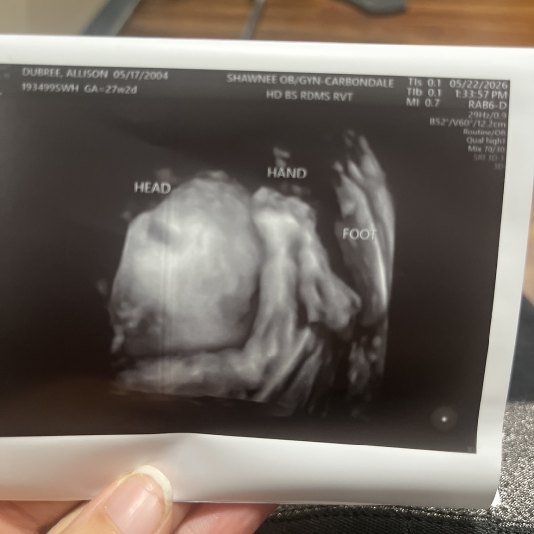 Photo shared by Ally for their Babylist baby registry.