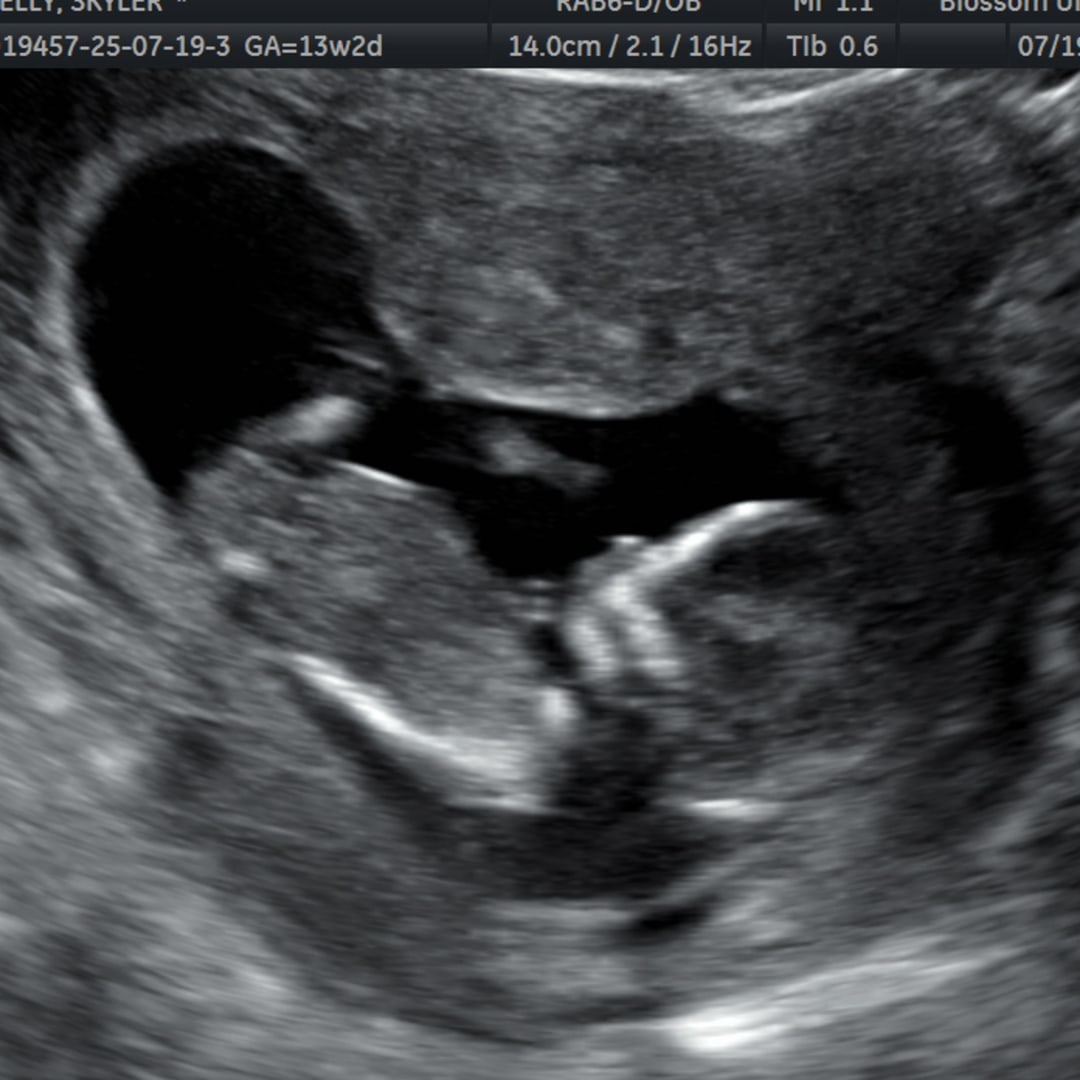 Photo shared by Skyler for their Babylist baby registry.