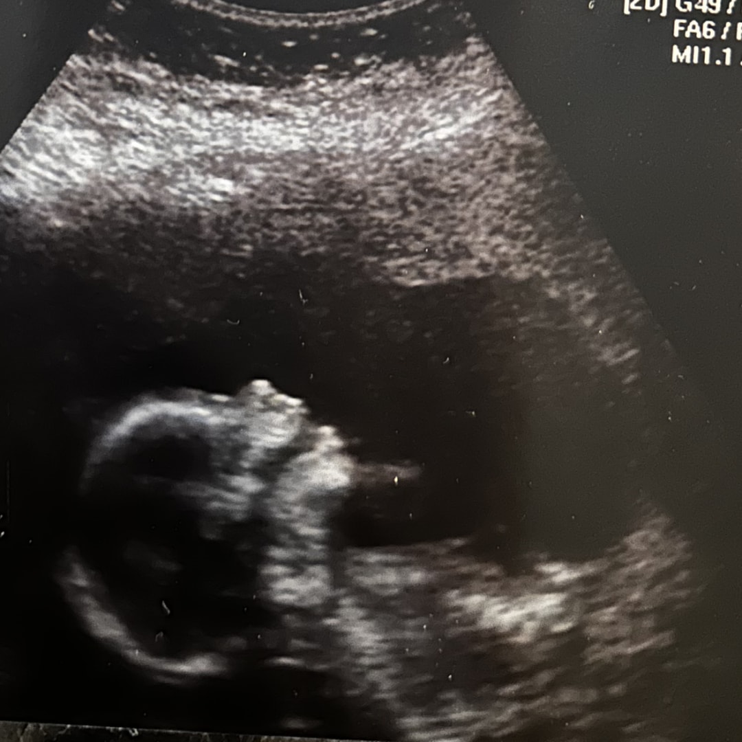 Photo shared by Layla for their Babylist baby registry.