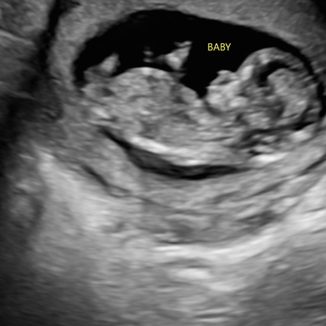 Photo shared by Stephanie for their Babylist baby registry.