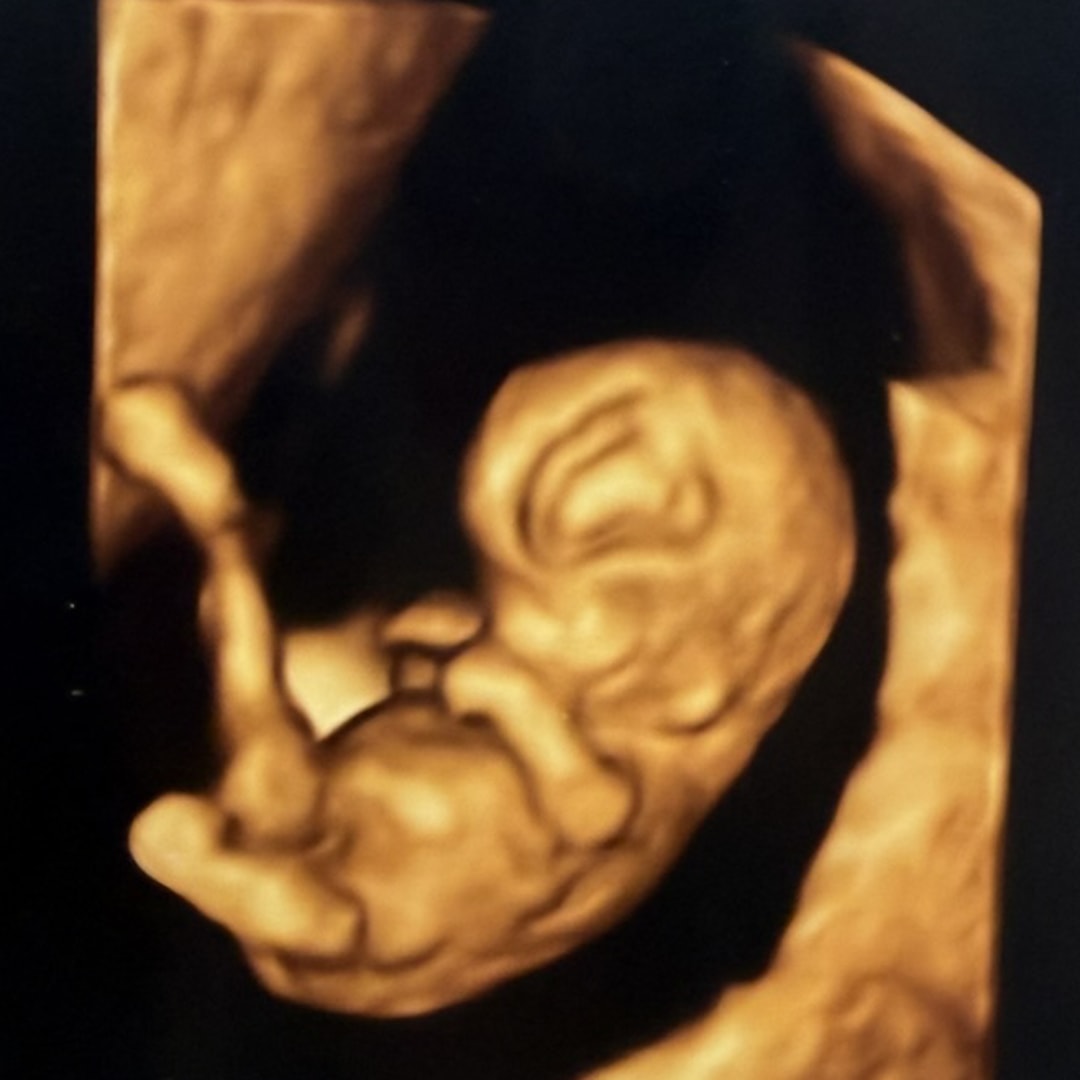 Photo shared by Emma for their Babylist baby registry.