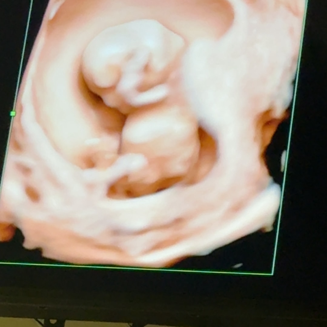 Photo shared by Raelynn for their Babylist baby registry.