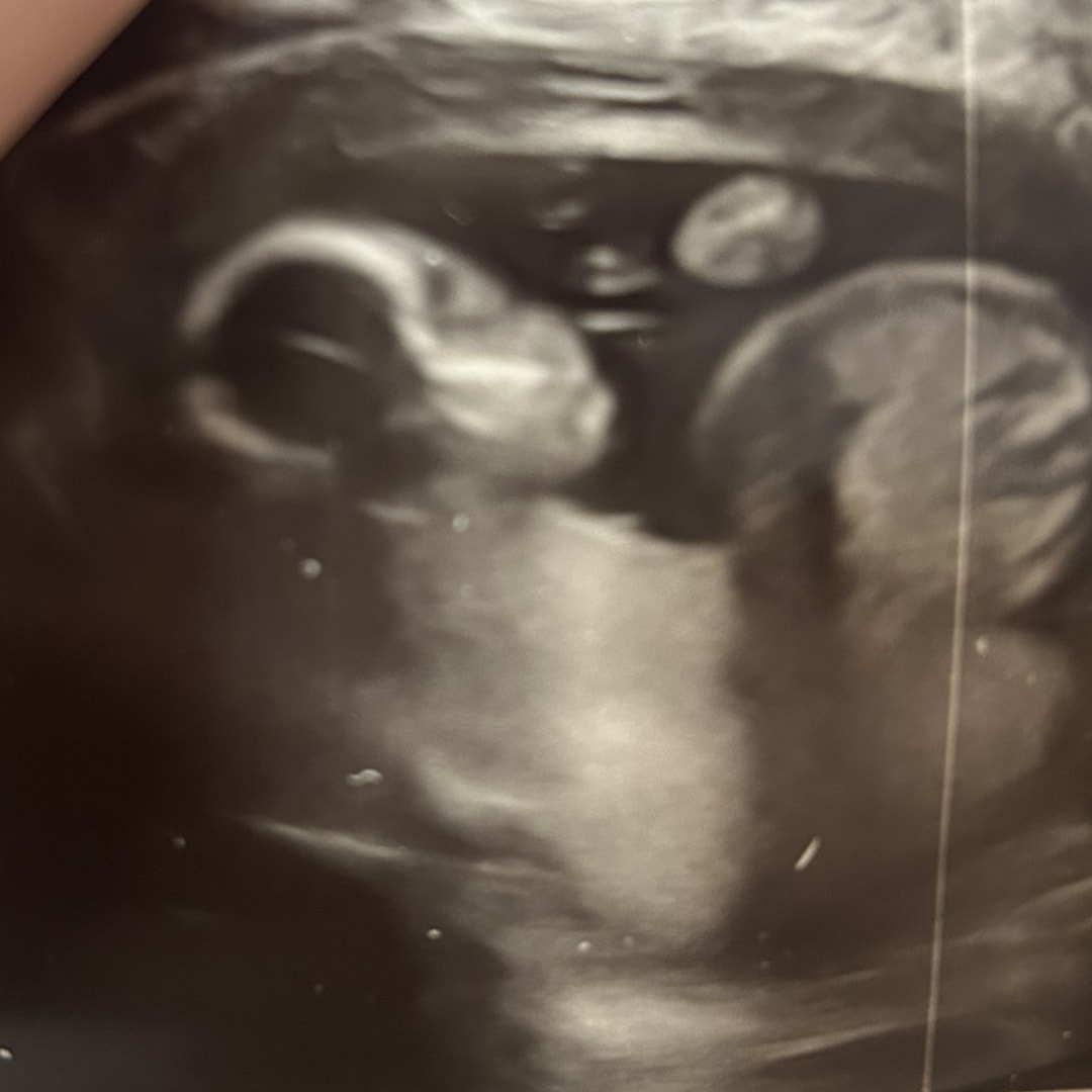 Photo shared by Grace for their Babylist baby registry.