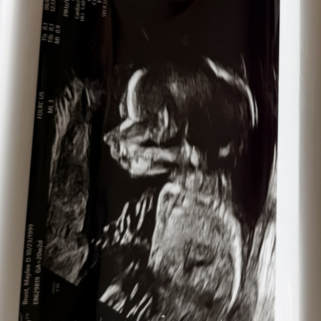 Photo shared by Maylee for their Babylist baby registry.