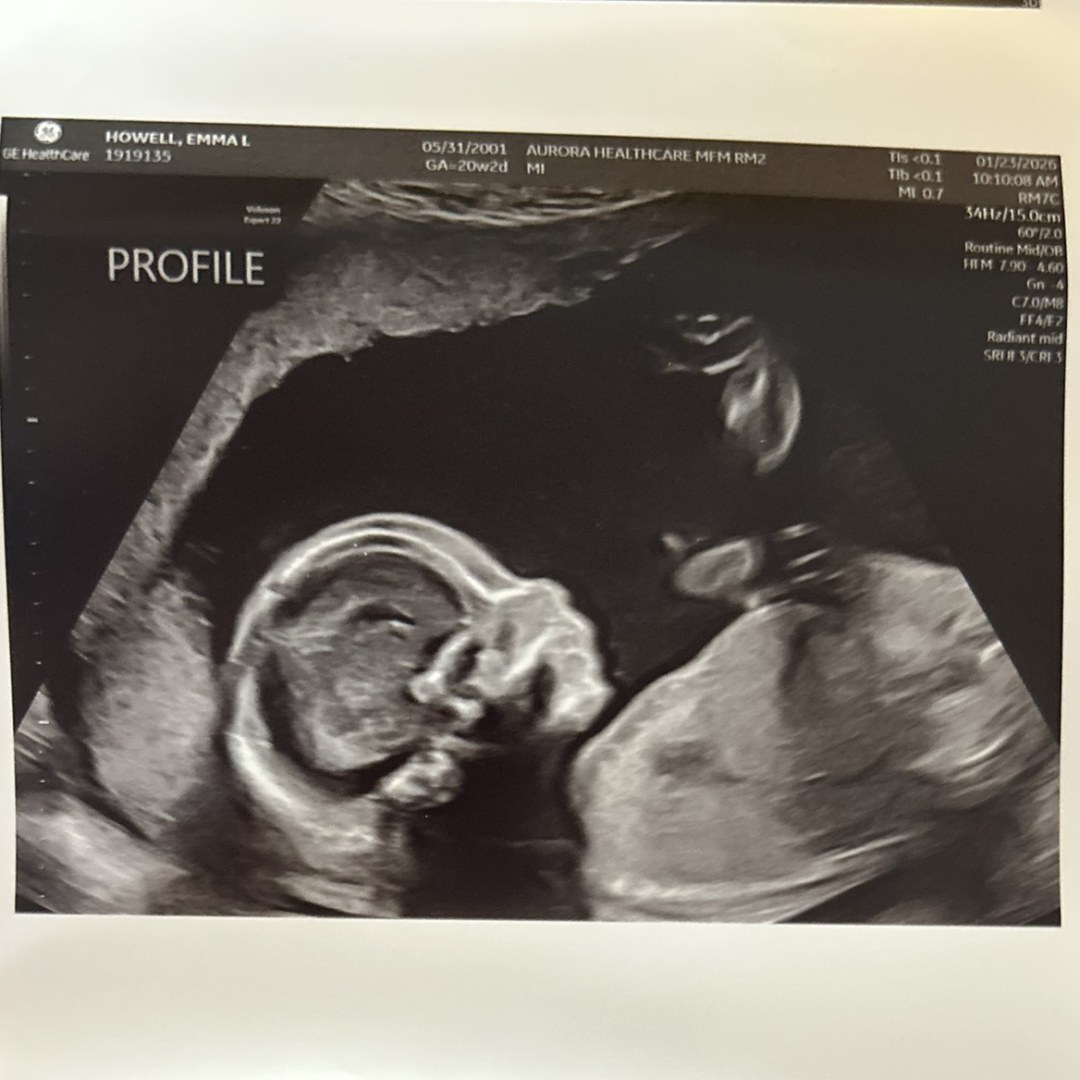Photo shared by Emma for their Babylist baby registry.