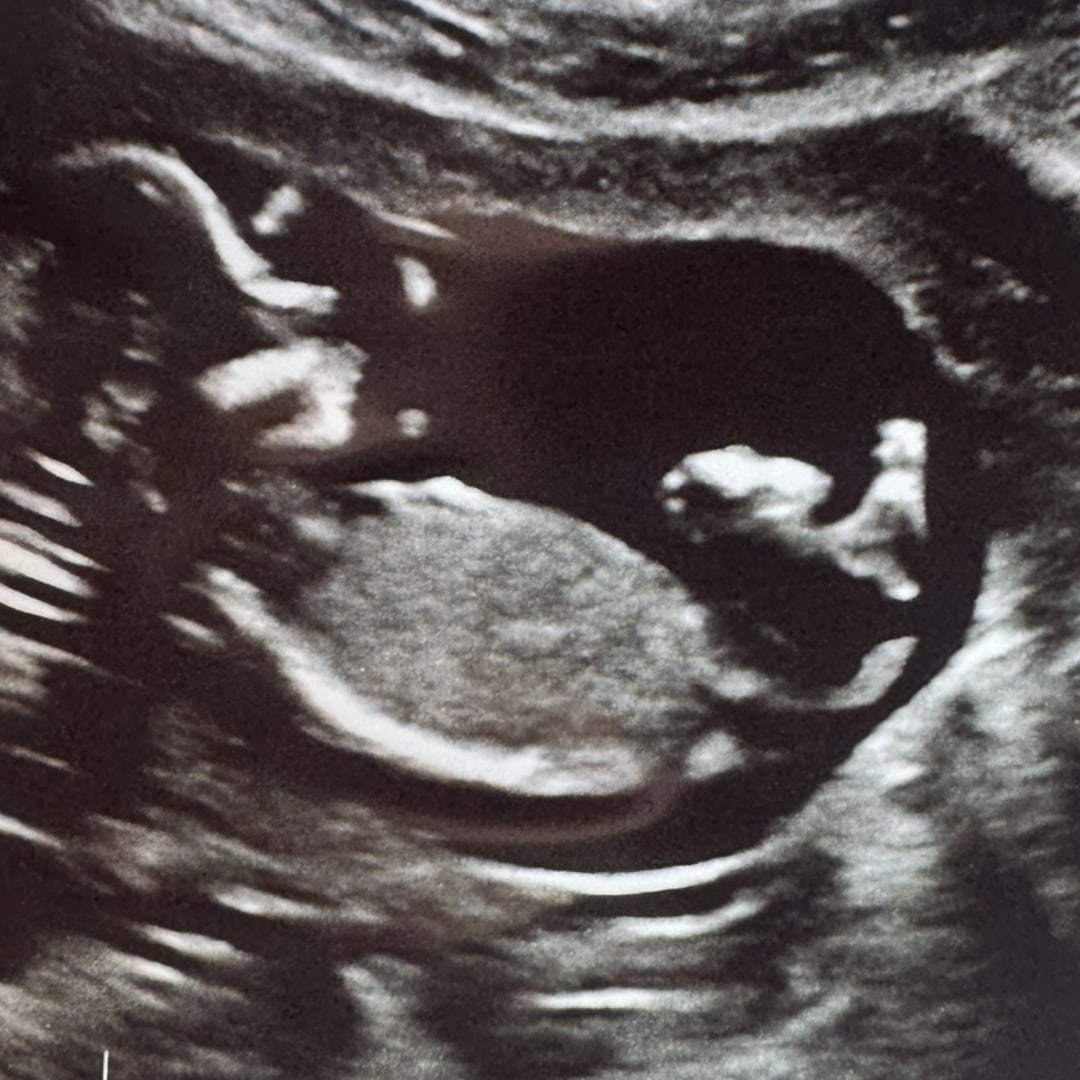 Photo shared by Abbey for their Babylist baby registry.