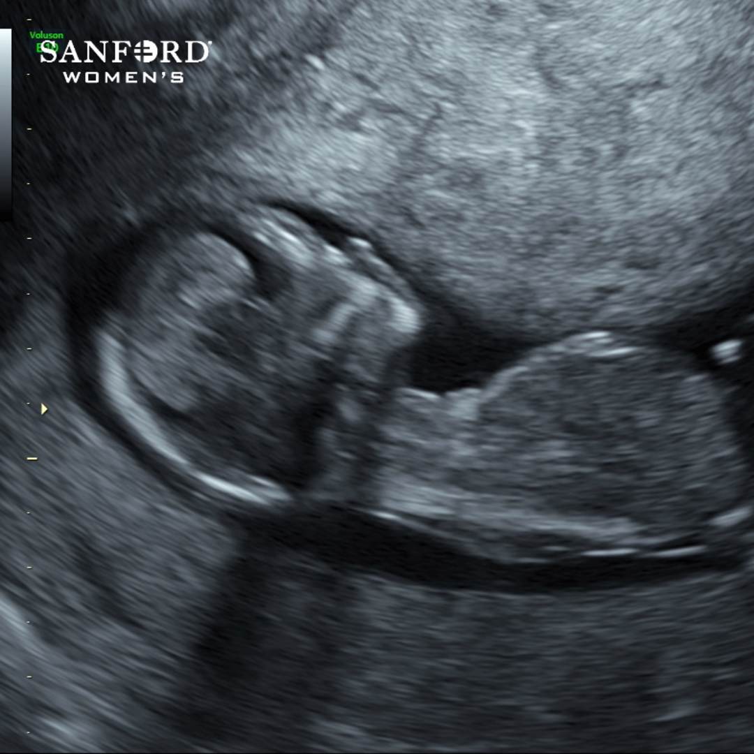 Photo shared by Orianah for their Babylist baby registry.