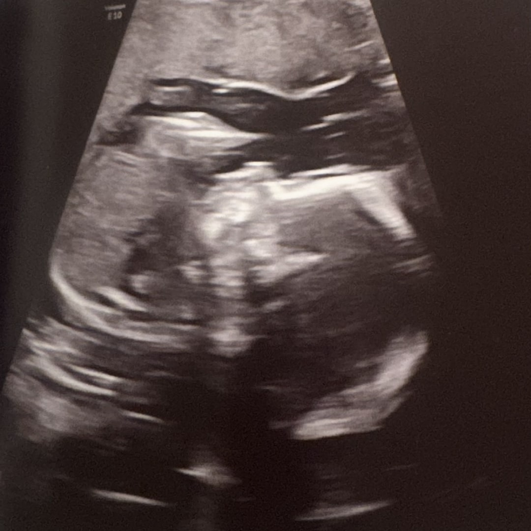 Photo shared by Saige for their Babylist baby registry.