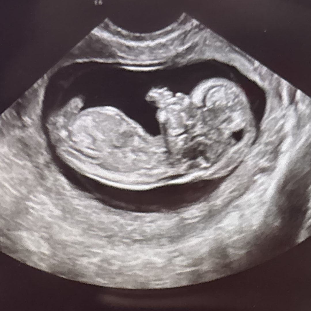 Photo shared by Erin for their Babylist baby registry.