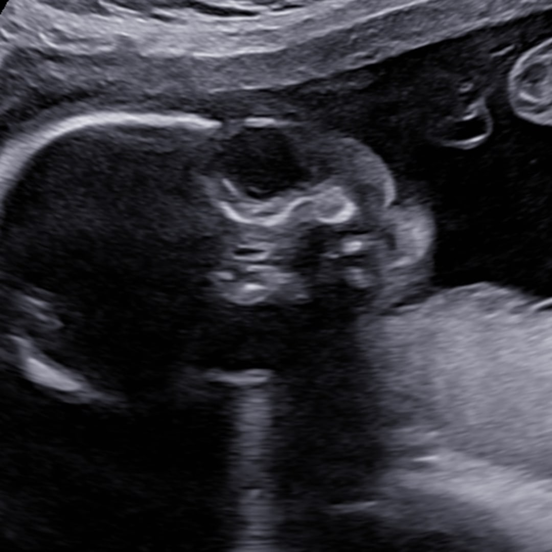 Photo shared by Autumn for their Babylist baby registry.