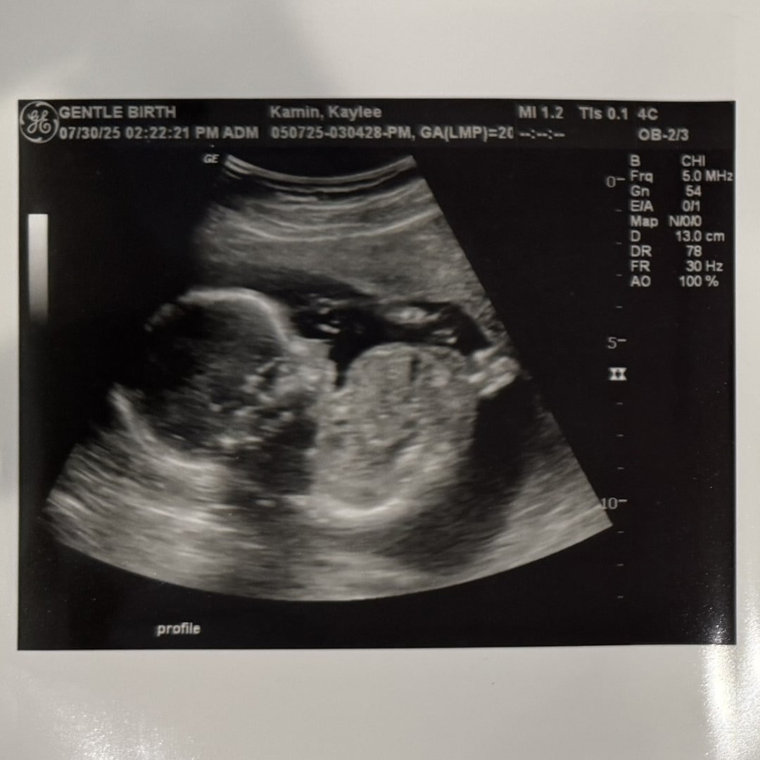 Photo shared by Kaylee for their Babylist baby registry.