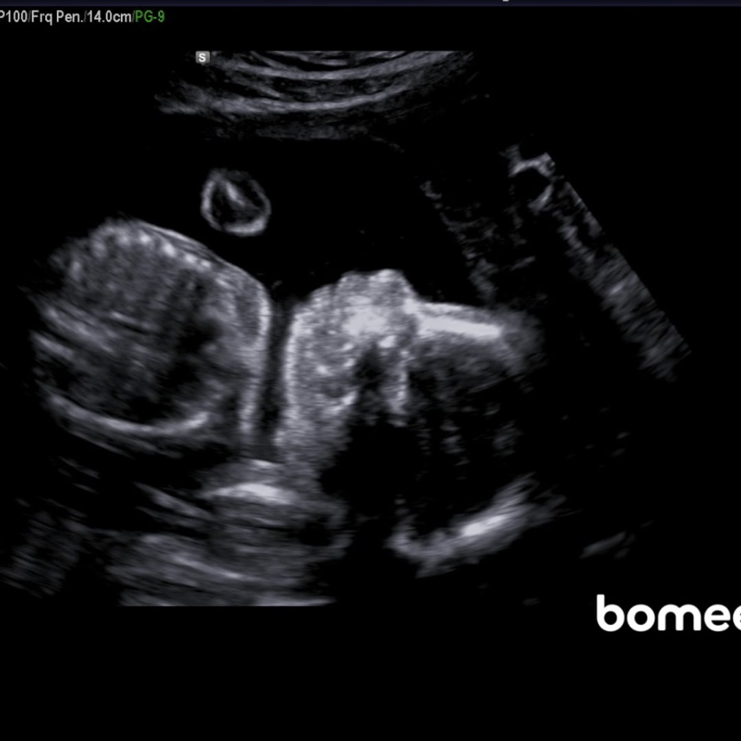 Photo shared by Addisyn for their Babylist baby registry.