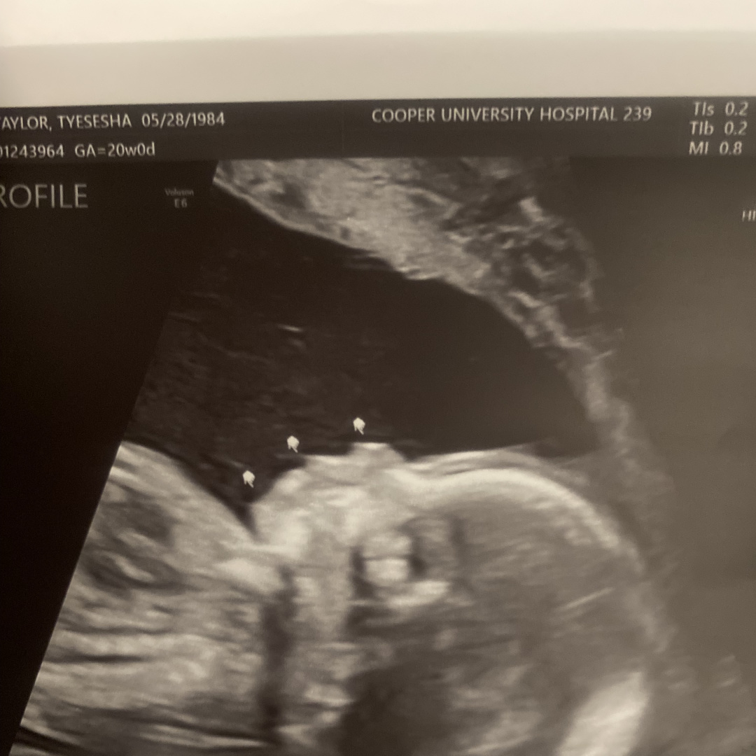 Photo shared by Tyesesha for their Babylist baby registry.