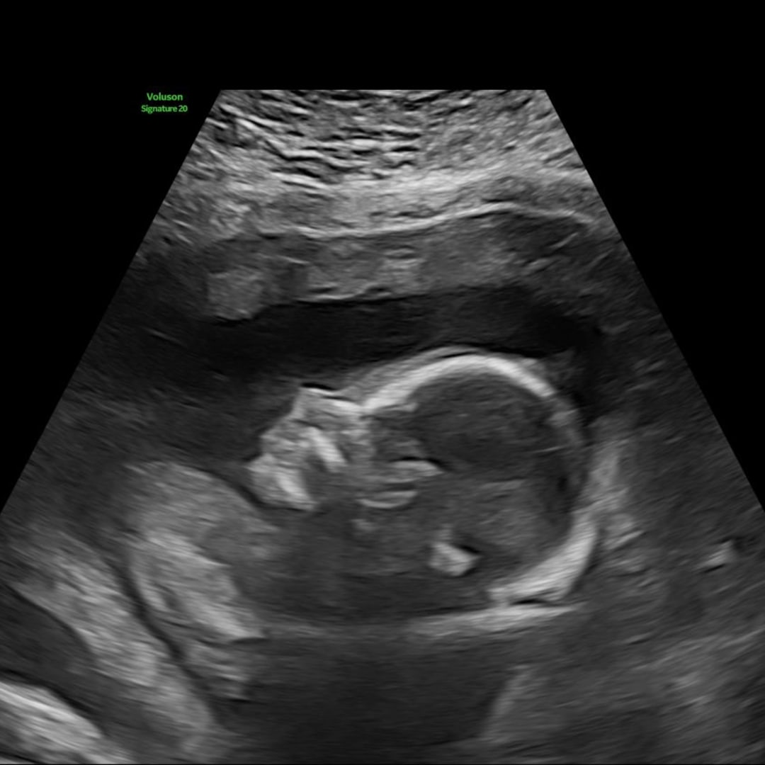 Photo shared by Laurin for their Babylist baby registry.