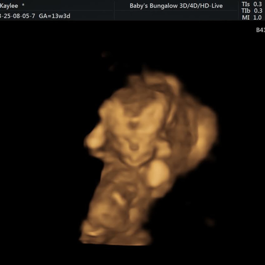 Photo shared by Kaylee for their Babylist baby registry.