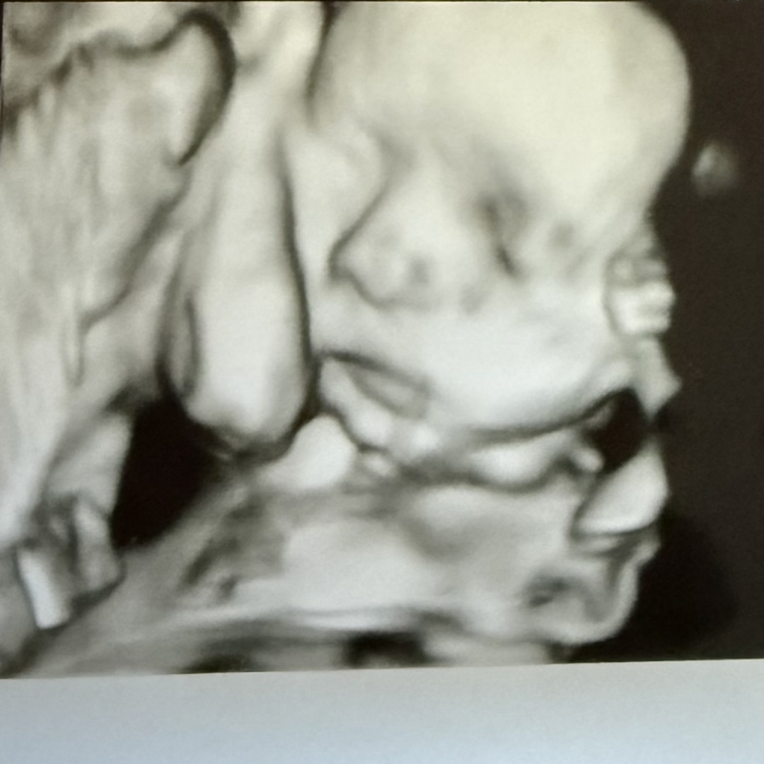 Photo shared by Ashley for their Babylist baby registry.