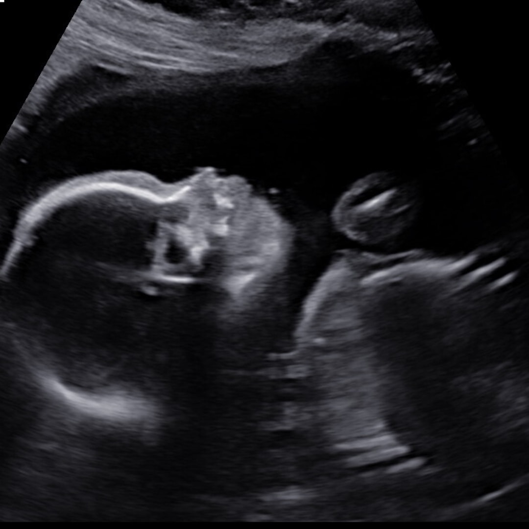 Photo shared by Kirsten for their Babylist baby registry.