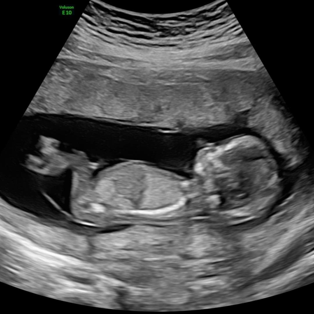 Photo shared by Alexsys for their Babylist baby registry.
