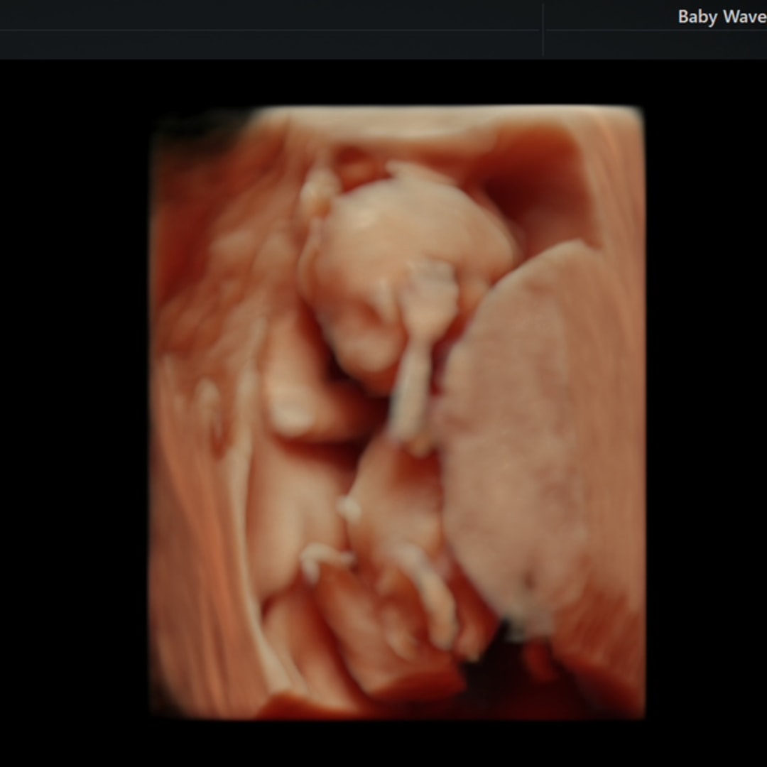 Photo shared by Isabella for their Babylist baby registry.