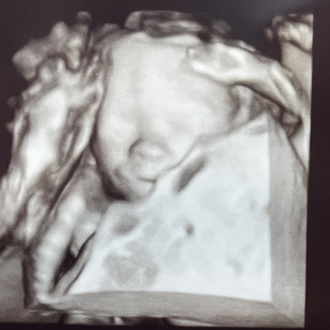 Photo shared by Issany for their Babylist baby registry.