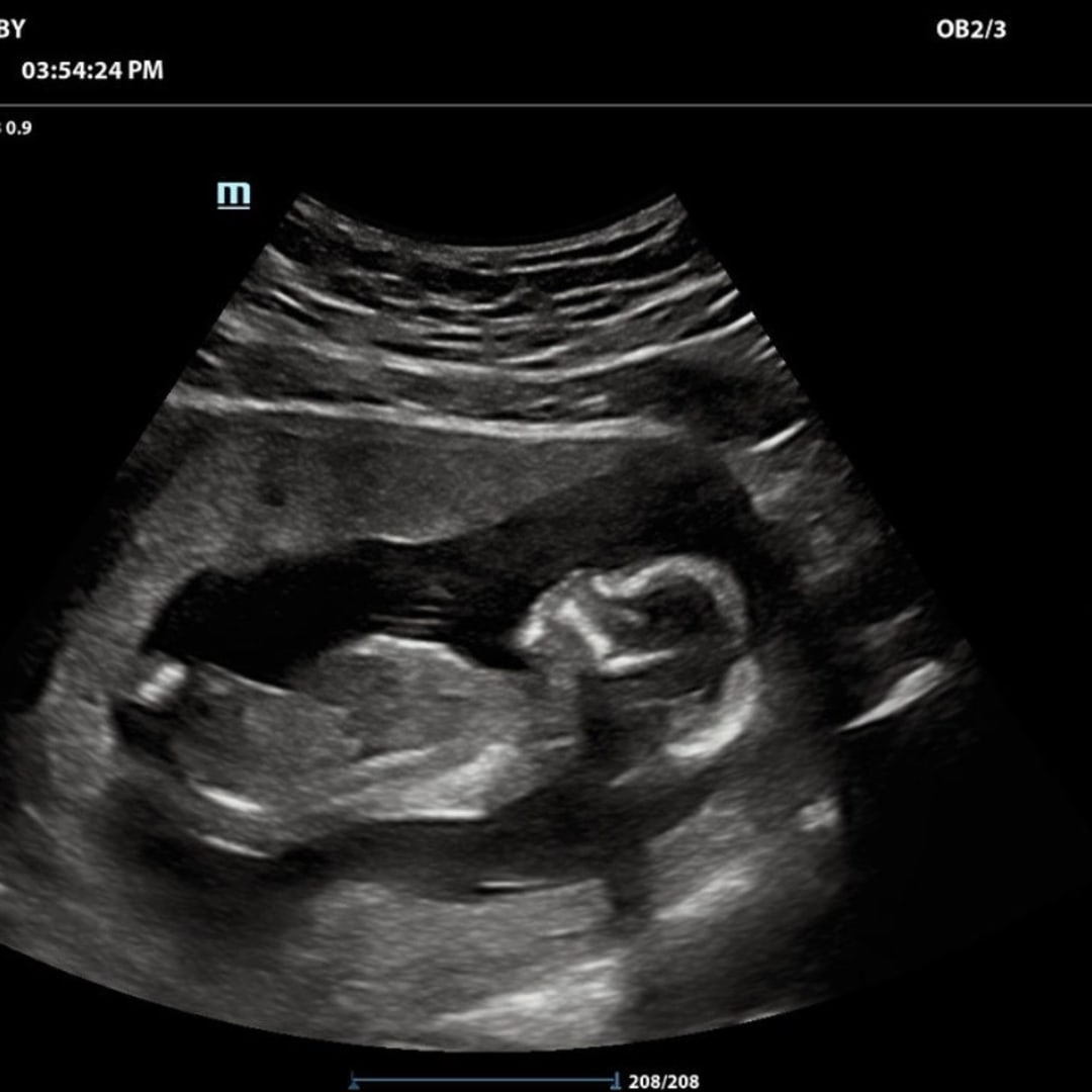 Photo shared by Natalie for their Babylist baby registry.