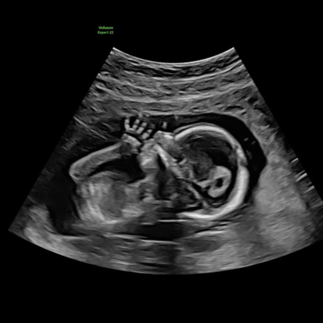 Photo shared by Grace for their Babylist baby registry.