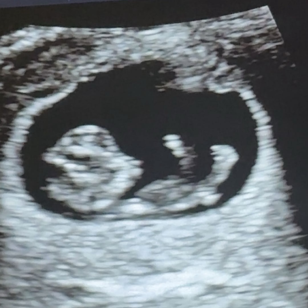 Photo shared by Lauren for their Babylist baby registry.