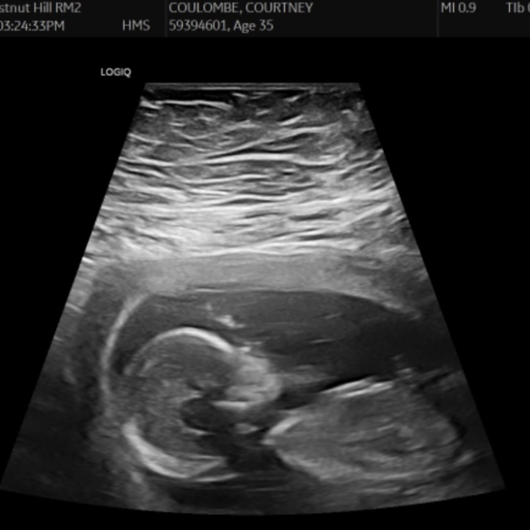 Photo shared by Courtney for their Babylist baby registry.