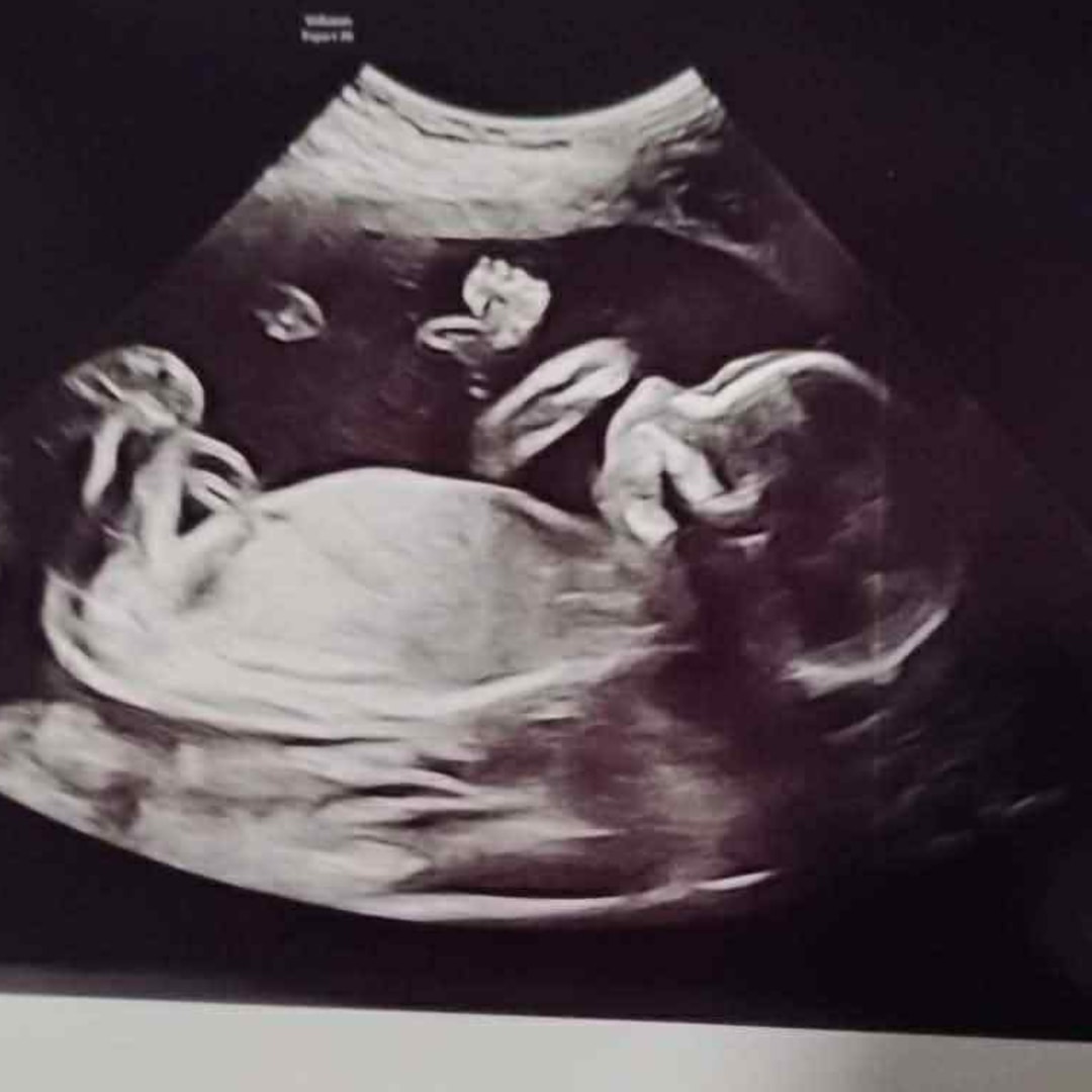 Photo shared by Elise for their Babylist baby registry.