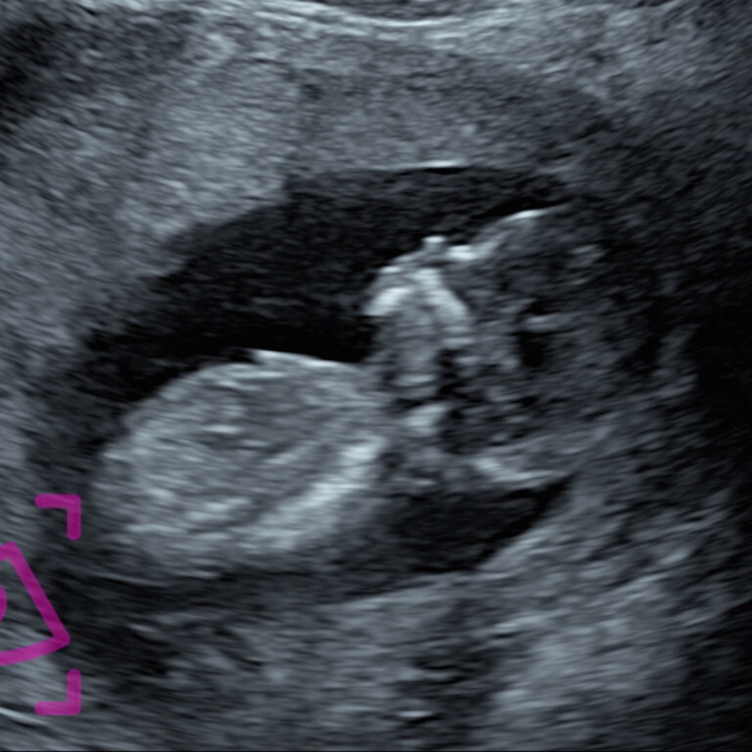 Photo shared by Emily for their Babylist baby registry.
