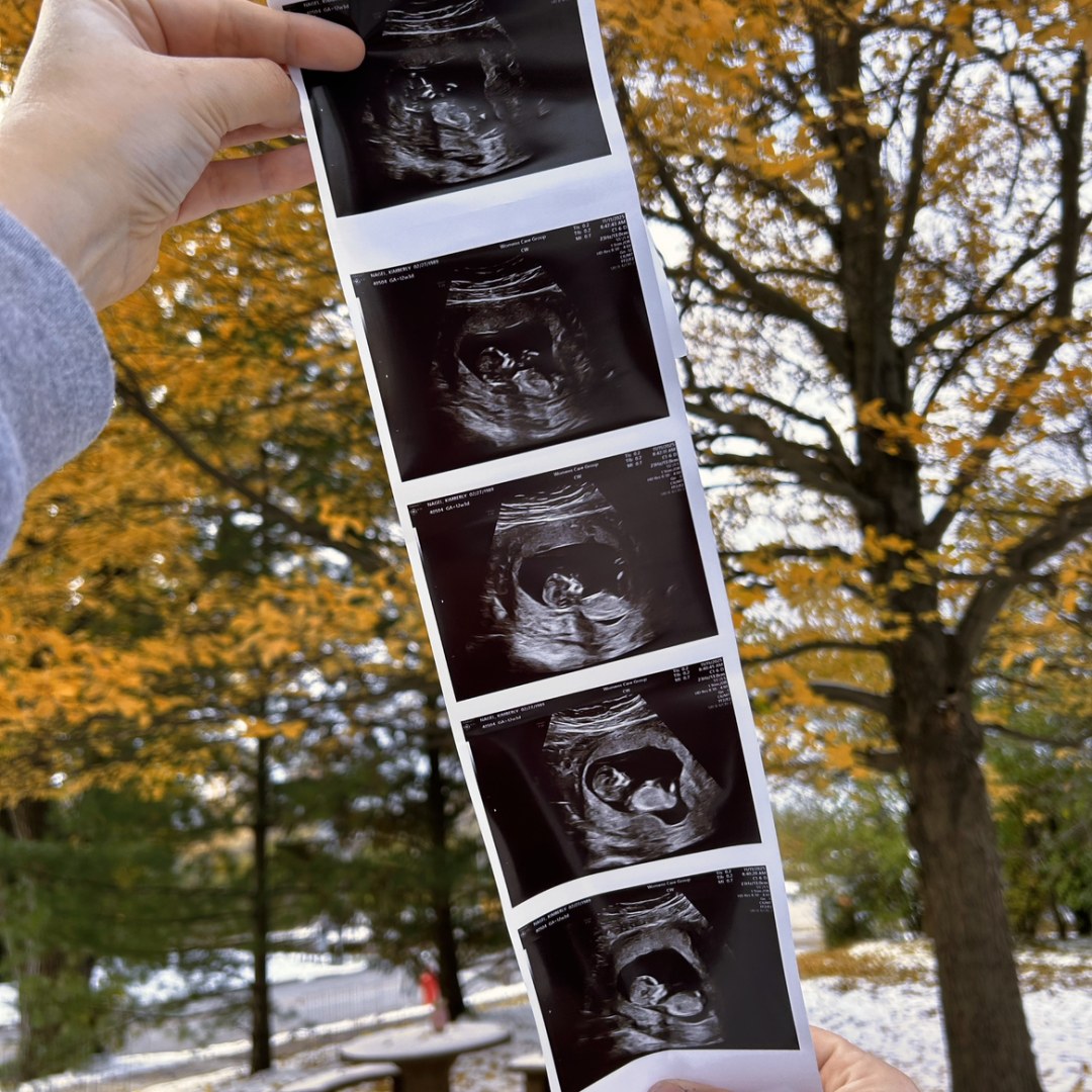 Photo shared by Kimberly for their Babylist baby registry.