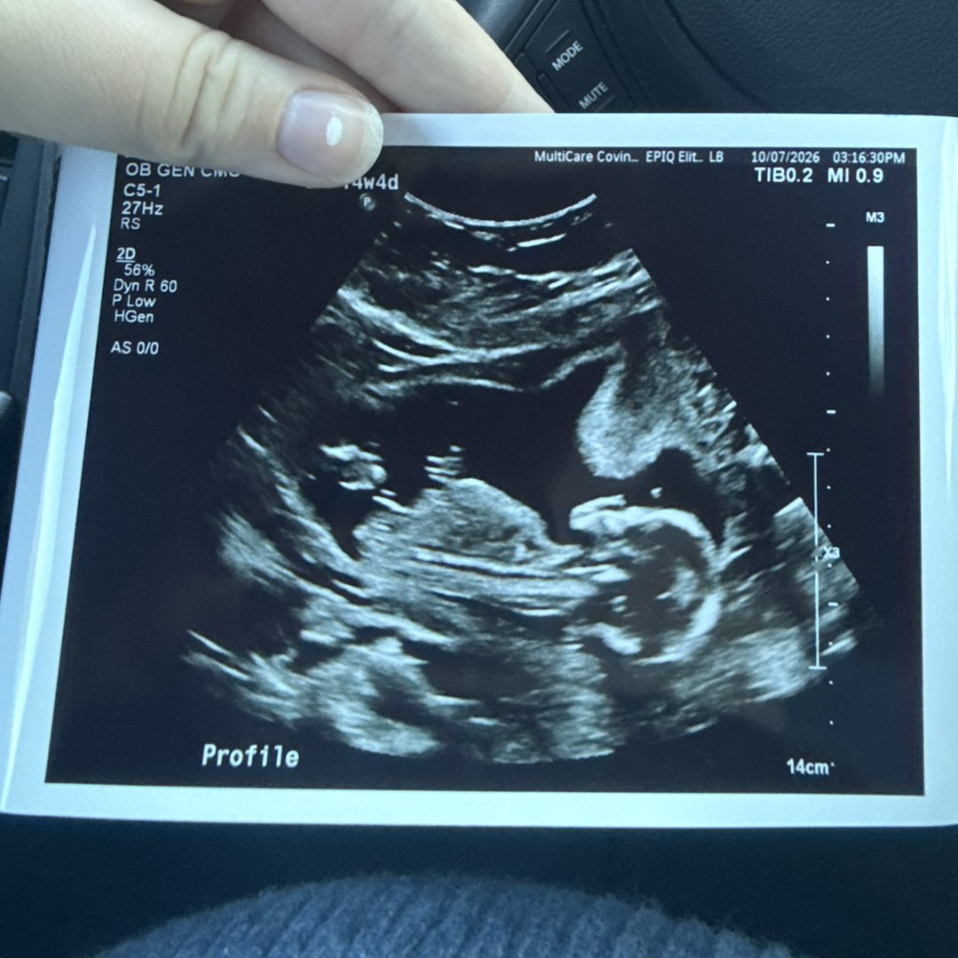 Photo shared by Bailey for their Babylist baby registry.