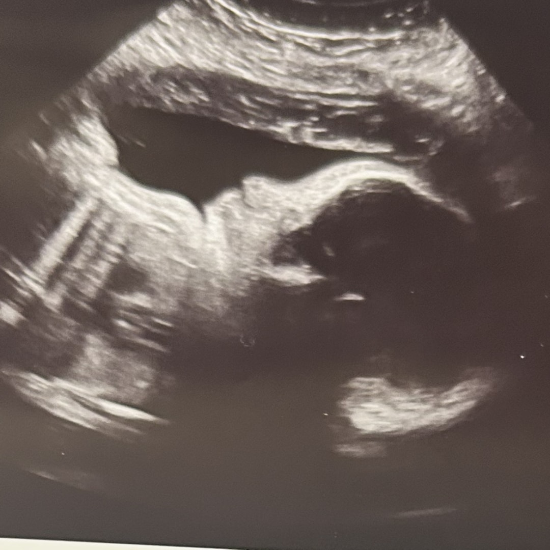 Photo shared by Annie for their Babylist baby registry.