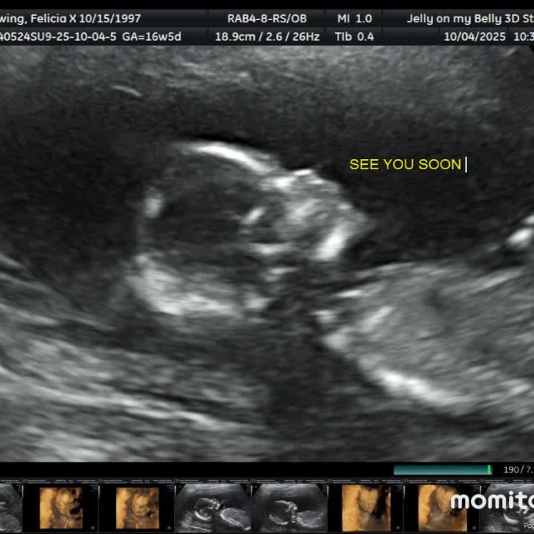 Photo shared by Felicia for their Babylist baby registry.