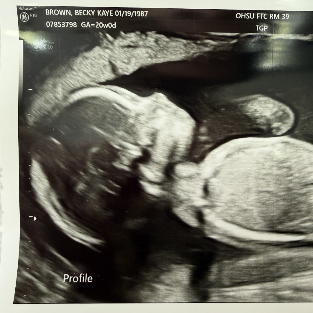 Photo shared by Becky for their Babylist baby registry.