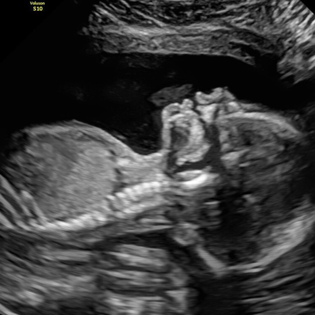 Photo shared by Julianna for their Babylist baby registry.