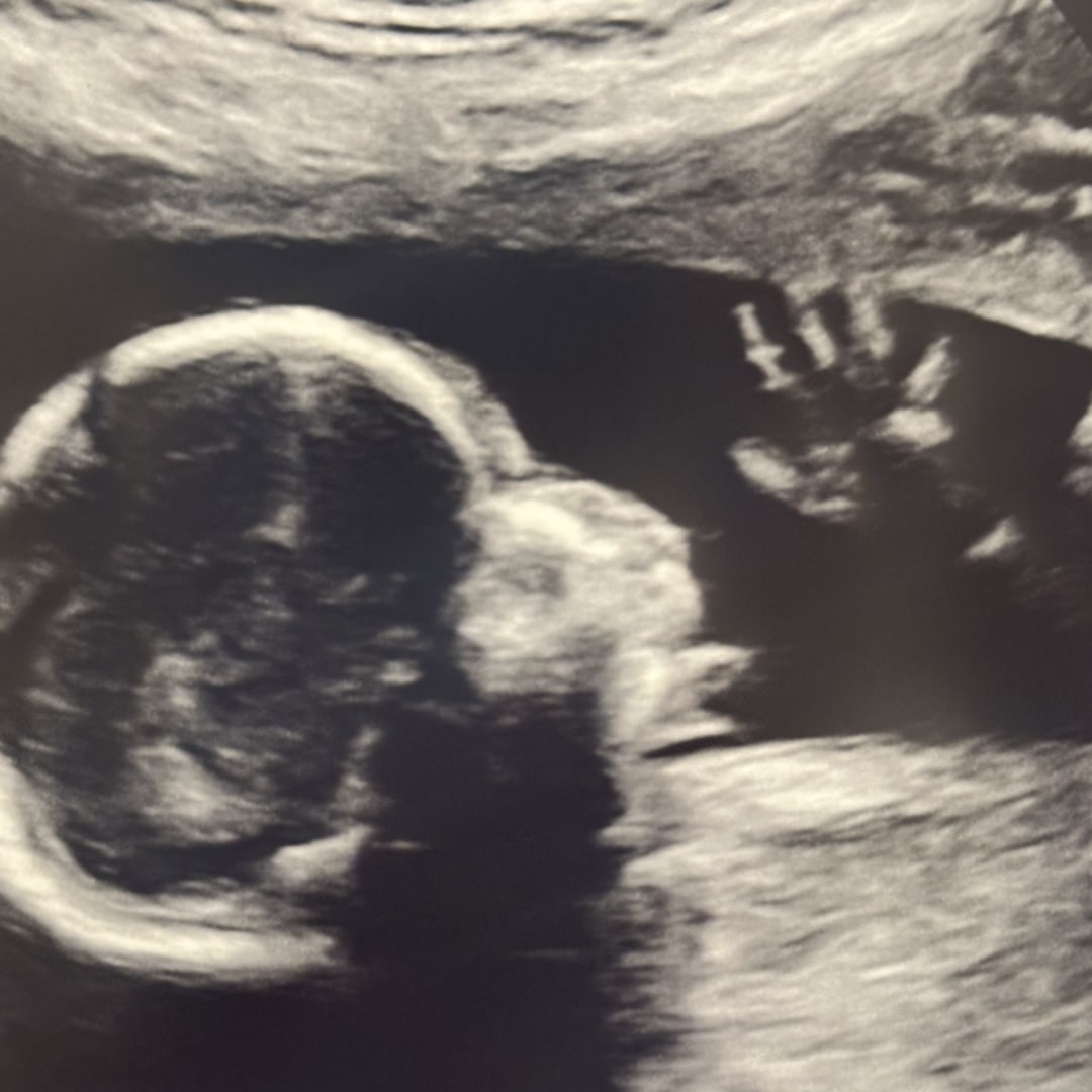 Photo shared by Collins for their Babylist baby registry.