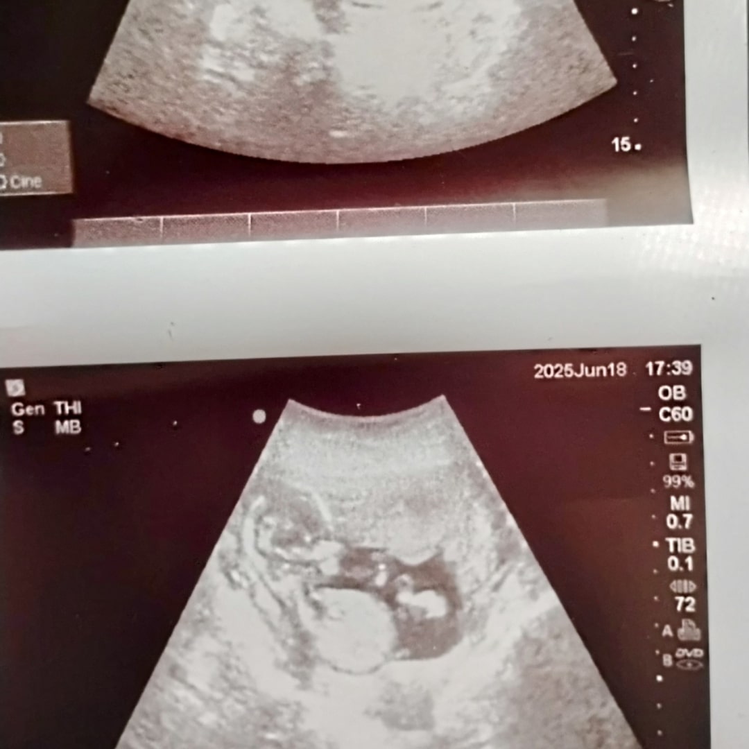 Photo shared by Rachelle for their Babylist baby registry.