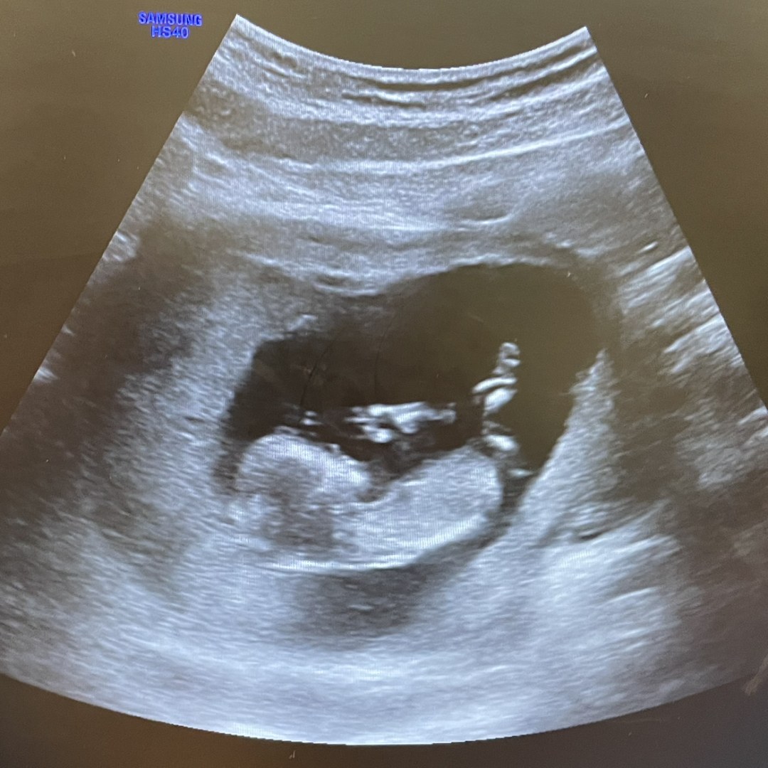 Photo shared by Jenna for their Babylist baby registry.