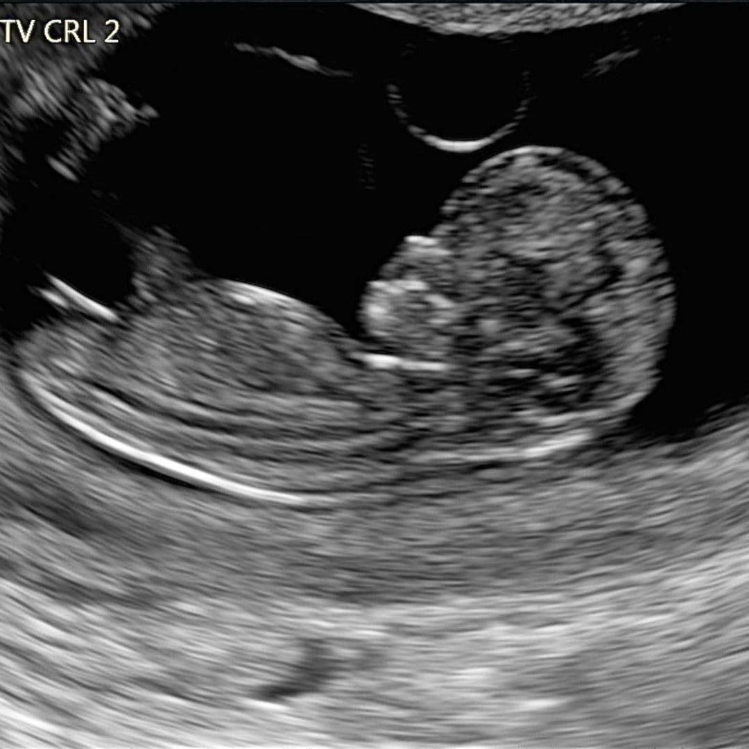 Photo shared by Acacia for their Babylist baby registry.