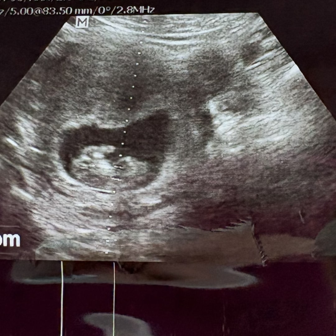 Photo shared by Jaelyn for their Babylist baby registry.