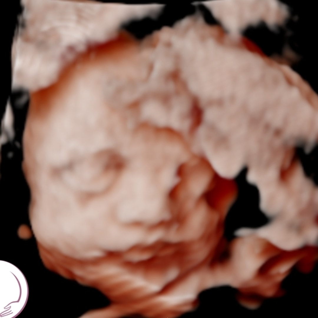 Photo shared by Adrianna for their Babylist baby registry.