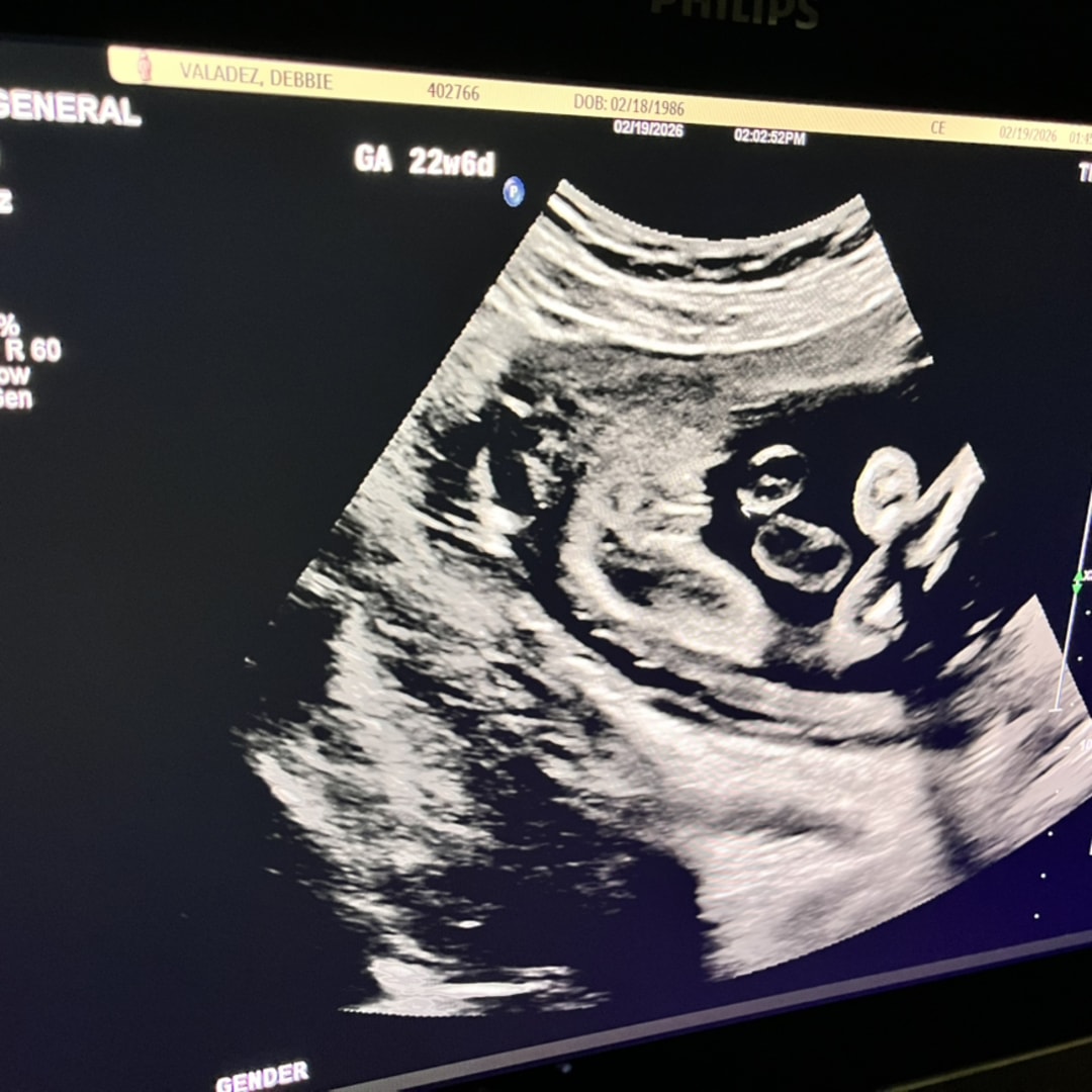 Photo shared by Debbie for their Babylist baby registry.