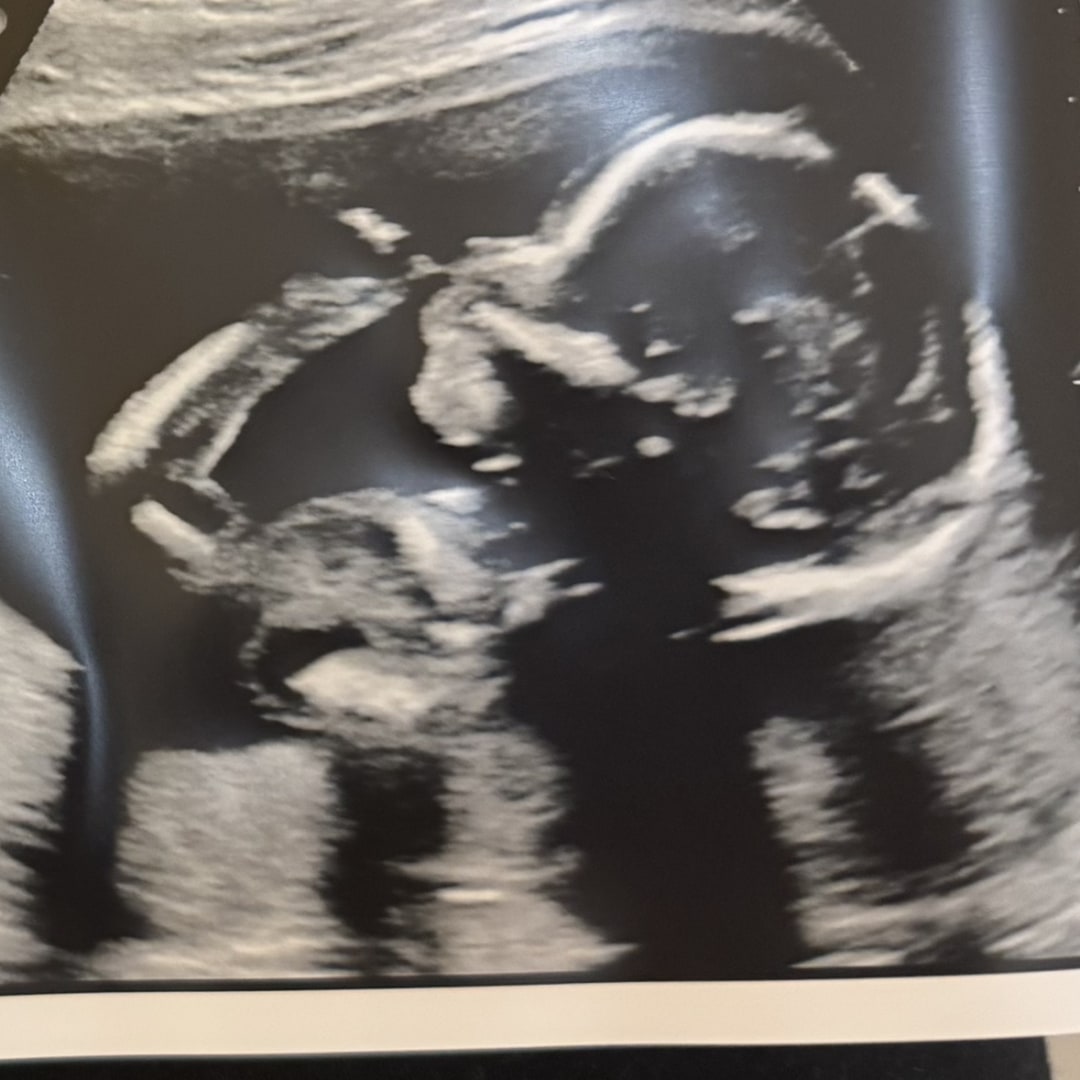 Photo shared by Renee for their Babylist baby registry.