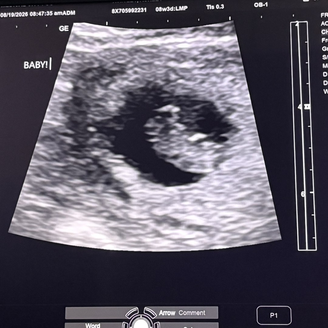 Photo shared by Ashlee for their Babylist baby registry.