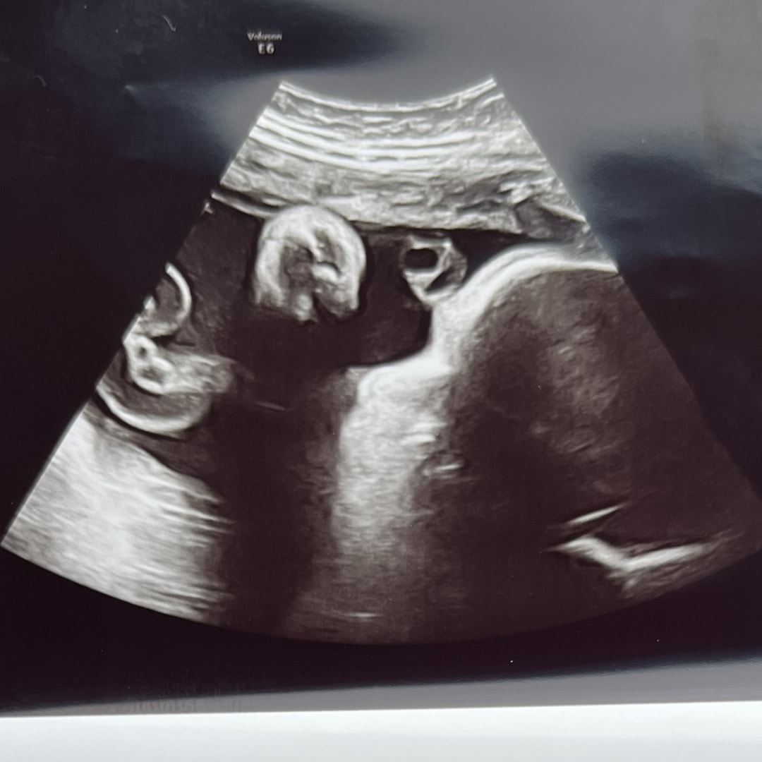 Photo shared by Daisy for their Babylist baby registry.