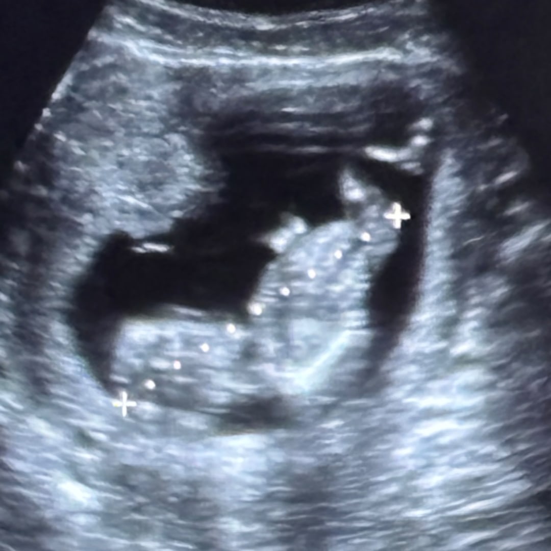 Photo shared by Giuliana for their Babylist baby registry.