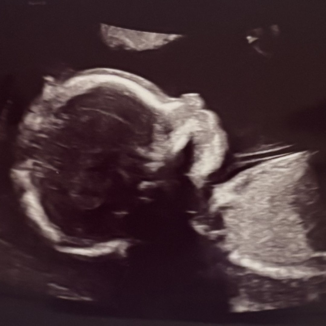 Photo shared by Chelsea for their Babylist baby registry.
