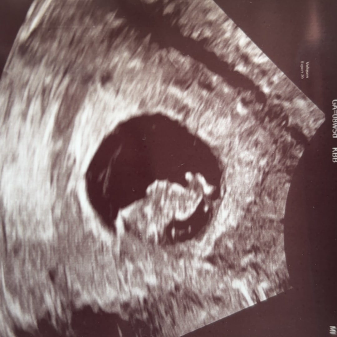 Photo shared by Carlie for their Babylist baby registry.