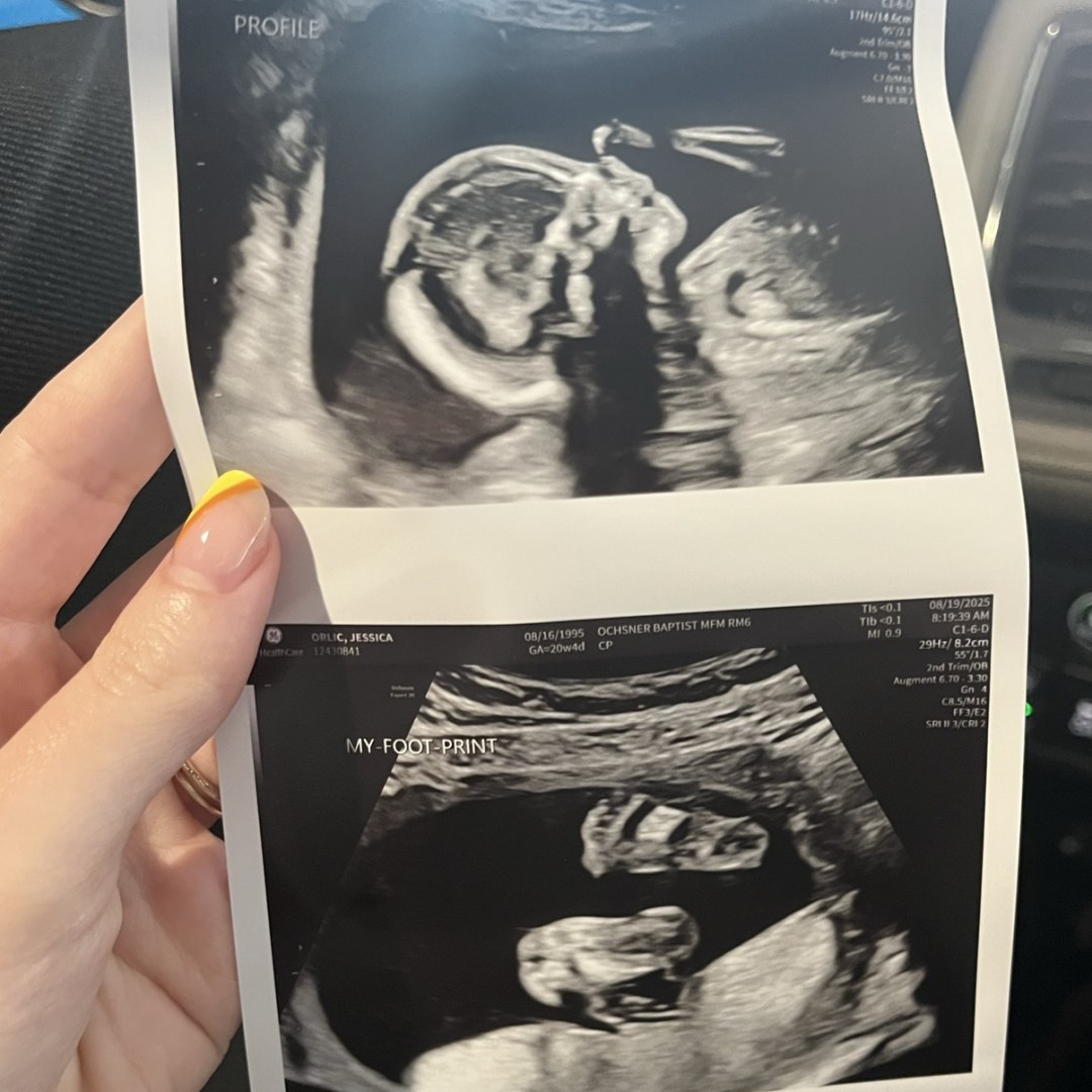Photo shared by Jessica for their Babylist baby registry.